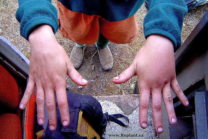 tree-planting-planters-wasp-bites